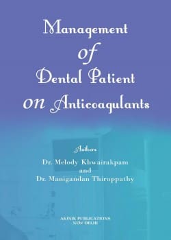 Management of Dental Patient on Anticoagulants