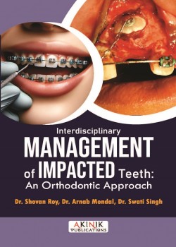 Interdisciplinary Management of Impacted Teeth: An Orthodontic Approach